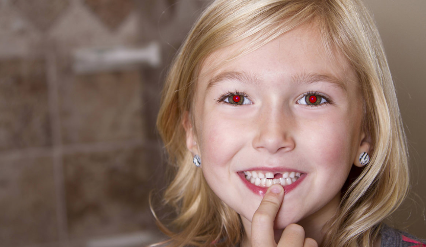 Red eyes in photos