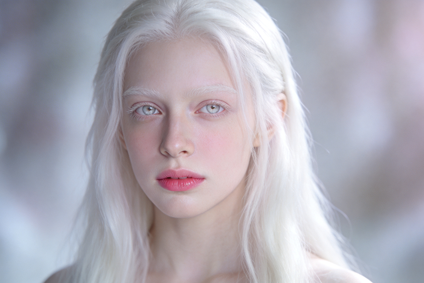 albino photo