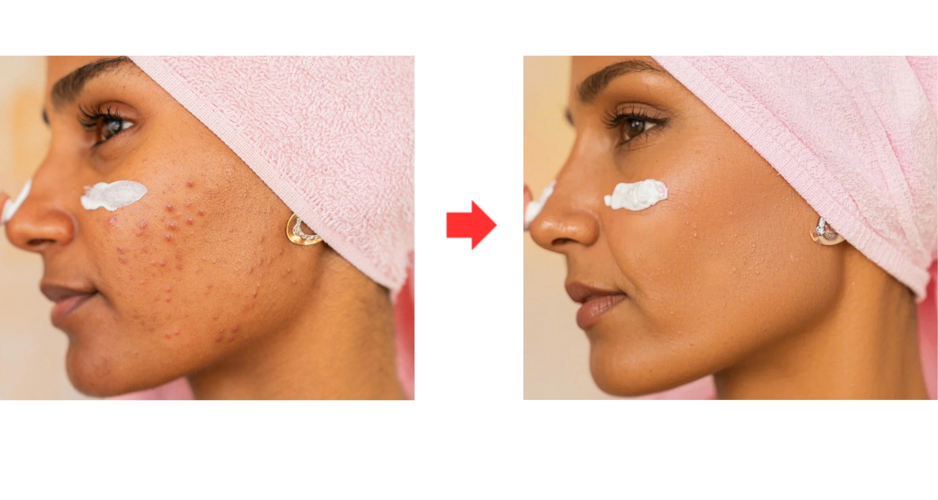 Retouch